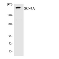 SCN4A / Nav1.4 Antibody - Western blot analysis of the lysates from COLO205 cells using SCN4A antibody.