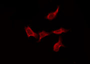 SCN4A / Nav1.4 Antibody - Staining HeLa cells by IF/ICC. The samples were fixed with PFA and permeabilized in 0.1% Triton X-100, then blocked in 10% serum for 45 min at 25°C. The primary antibody was diluted at 1:200 and incubated with the sample for 1 hour at 37°C. An Alexa Fluor 594 conjugated goat anti-rabbit IgG (H+L) Ab, diluted at 1/600, was used as the secondary antibody.