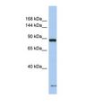 SCN7A Antibody - Western blot of Human Fetal Thymus. SCN7A antibody dilution 1.0 ug/ml.  This image was taken for the unconjugated form of this product. Other forms have not been tested.