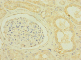 SCN7A Antibody - Immunohistochemistry of paraffin-embedded human kidney tissue at dilution 1:100