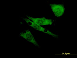 SCN8A / Nav1.6 Antibody - Immunofluorescence of monoclonal antibody to SCN8A on NIH/3T3 cell. [antibody concentration 10 ug/ml]