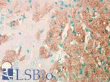 SCN9A / Nav1.7 Antibody - IHC analysis of Nav1.7 in mouse brain tissue using a dilution of SCN9A / Nav1.7 antibody.  This image was taken for the unconjugated form of this product. Other forms have not been tested.