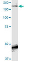 SCN9A / Nav1.7 Antibody - SCN9A monoclonal antibody (M01), clone 5A11. Western Blot analysis of SCN9A expression in rat testis.