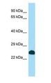 SCNM1 Antibody - SCNM1 antibody Western Blot of HepG2.  This image was taken for the unconjugated form of this product. Other forms have not been tested.