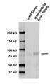 SCNN1A / ENaC Alpha Antibody - Western blot analysis of ENaC-Alpha in rat kidney tissue using a 1:1000 dilution of SCNN1A / ENaC Apha antibody.  This image was taken for the unconjugated form of this product. Other forms have not been tested.