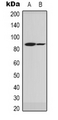 SCNN1G / ENaC Gamma Antibody - Western blot analysis of Gamma-NaCH expression in A549 (A); HEK293T (B) whole cell lysates.