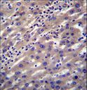 SCP2 / SCPX Antibody - SCP2 Antibody immunohistochemistry of formalin-fixed and paraffin-embedded human liver tissue followed by peroxidase-conjugated secondary antibody and DAB staining.