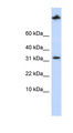 SCP2 / SCPX Antibody - SCP2 antibody Western blot of MCF7 cell lysate. This image was taken for the unconjugated form of this product. Other forms have not been tested.