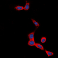 SCTR / SR / Secretin Receptor Antibody - Immunofluorescent analysis of Secretin Receptor staining in SHSY5Y cells. Formalin-fixed cells were permeabilized with 0.1% Triton X-100 in TBS for 5-10 minutes and blocked with 3% BSA-PBS for 30 minutes at room temperature. Cells were probed with the primary antibody in 3% BSA-PBS and incubated overnight at 4 deg C in a humidified chamber. Cells were washed with PBST and incubated with a DyLight 594-conjugated secondary antibody (red) in PBS at room temperature in the dark. DAPI was used to stain the cell nuclei (blue).