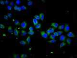 SCUBE1 Antibody - Immunofluorescence staining of Hela cells diluted at 1:133, counter-stained with DAPI. The cells were fixed in 4% formaldehyde, permeabilized using 0.2% Triton X-100 and blocked in 10% normal Goat Serum. The cells were then incubated with the antibody overnight at 4°C.The Secondary antibody was Alexa Fluor 488-congugated AffiniPure Goat Anti-Rabbit IgG (H+L).