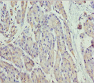 SCYL1 / NTKL Antibody - Immunohistochemistry of paraffin-embedded human pancreatic tissue at dilution 1:100