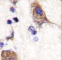 SCYL2 Antibody - Formalin-fixed and paraffin-embedded human brain tissue reacted with SCYL2 , which was peroxidase-conjugated to the secondary antibody, followed by DAB staining. This data demonstrates the use of this antibody for immunohistochemistry; clinical relevance has not been evaluated.