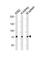 SDAD1 Antibody - Western blot of lysates from K562 cell line, human kidney, mouse spleen tissue (from left to right) with SDAD1 Antibody. Antibody was diluted at 1:1000 at each lane. A goat anti-rabbit IgG H&L (HRP) at 1:10000 dilution was used as the secondary antibody. Lysates at 20 ug per lane.