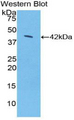 SDC1 / Syndecan 1 / CD138 Antibody - Western blot of recombinant SDC1 / Syndecan 1 / CD138.  This image was taken for the unconjugated form of this product. Other forms have not been tested.