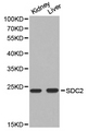 SDC2 / Syndecan 2 Antibody - Western blot of extracts of various cell lines, using SDC2 antibody.