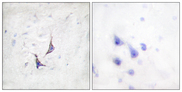 SDC4 / Syndecan 4 Antibody - Immunohistochemistry analysis of paraffin-embedded human brain tissue, using Syndecan4 Antibody. The picture on the right is blocked with the synthesized peptide.