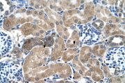 SDCBP / Syntenin Antibody - SDCBP / Syntenin antibody ARP44535_T100-NP_001007068-SDCBP(syndecan binding protein (syntenin)) Antibody IHC of formalin-fixed, paraffin-embedded human Kidney. Positive label: Epithelial cells of renal tubule indicated with arrows. Antibody concentration 4-8 ug/ml. Magnification 400X.  This image was taken for the unconjugated form of this product. Other forms have not been tested.