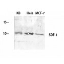 SDF1 / CXCL12 Antibody - Western blot of SDF-1 antibody
