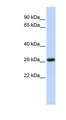 SDHB Antibody - SDHB antibody Western blot of Jurkat lysate. This image was taken for the unconjugated form of this product. Other forms have not been tested.
