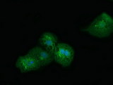 SDR9C7 Antibody - Anti-SDR9C7 mouse monoclonal antibody immunofluorescent staining of COS7 cells transiently transfected by pCMV6-ENTRY SDR9C7.