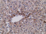 SDR9C7 Antibody - IHC of paraffin-embedded Human liver tissue using anti-SDR9C7 mouse monoclonal antibody.