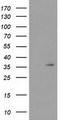SDR9C7 Antibody - HEK293T cells were transfected with the pCMV6-ENTRY control (Left lane) or pCMV6-ENTRY SDR9C7 (Right lane) cDNA for 48 hrs and lysed. Equivalent amounts of cell lysates (5 ug per lane) were separated by SDS-PAGE and immunoblotted with anti-SDR9C7.