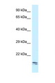 SEC11C Antibody - SEC11C antibody Western blot of Small Intestine lysate. Antibody concentration 1 ug/ml.  This image was taken for the unconjugated form of this product. Other forms have not been tested.