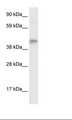 SEC14L2 Antibody - Fetal Liver Lysate.  This image was taken for the unconjugated form of this product. Other forms have not been tested.