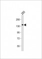 SEC24B Antibody - Anti-SEC24B Antibody (C-Term) at 1:2000 dilution + 293 whole cell lysate Lysates/proteins at 20 µg per lane. Secondary Goat Anti-Rabbit IgG, (H+L), Peroxidase conjugated at 1/10000 dilution. Predicted band size: 137 kDa Blocking/Dilution buffer: 5% NFDM/TBST.
