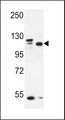 SEC24C Antibody - SEC24C Antibody western blot of MDA-MB435,MCF-7 cell line lysates (35 ug/lane). The SEC24C antibody detected the SEC24C protein (arrow).