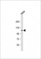 SEC24D Antibody - Anti-SEC24D Antibody (N-Term) at 1:2000 dilution + Hela whole cell lysate Lysates/proteins at 20 µg per lane. Secondary Goat Anti-Rabbit IgG, (H+L), Peroxidase conjugated at 1/10000 dilution. Predicted band size: 113 kDa Blocking/Dilution buffer: 5% NFDM/TBST.