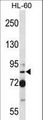 SECISBP2 / SBP2 Antibody - SECISBP2 Antibody western blot of HL-60 cell line lysates (35 ug/lane). The SECISBP2 antibody detected the SECISBP2 protein (arrow).
