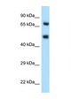 SELE / CD62E / E-selectin Antibody - SELE / CD62E antibody Western blot of HT1080 Cell lysate. Antibody concentration 1 ug/ml. This image was taken for the unconjugated form of this product. Other forms have not been tested.