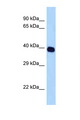 SELL / L-Selectin / CD62L Antibody - SELL / L-Selectin antibody Western blot of HepG2 Cell lysate. Antibody concentration 1 ug/ml.  This image was taken for the unconjugated form of this product. Other forms have not been tested.