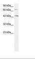 SEMA4A / Semaphorin 4A Antibody - HepG2 Cell Lysate.  This image was taken for the unconjugated form of this product. Other forms have not been tested.