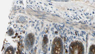 SEMA4A / Semaphorin 4A Antibody - 1:100 staining mouse intestine tissue by IHC-P. The sample was formaldehyde fixed and a heat mediated antigen retrieval step in citrate buffer was performed. The sample was then blocked and incubated with the antibody for 1.5 hours at 22°C. An HRP conjugated goat anti-rabbit antibody was used as the secondary.