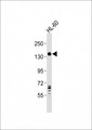 SEMA4D / Semaphorin 4D / CD100 Antibody - Anti-SEMA4D Antibody at 1:2000 dilution + HL-60 whole cell lysates Lysates/proteins at 20 ug per lane. Secondary Goat Anti-Rabbit IgG, (H+L), Peroxidase conjugated at 1/10000 dilution Predicted band size : 96 kDa Blocking/Dilution buffer: 5% NFDM/TBST.