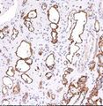 SEMA4D / Semaphorin 4D / CD100 Antibody - Immunohistochemistry of formalin-fixed, paraffin-embedded kidney transplant tissue (40X) stained with Complement 4d antibody (1:200), peroxidase-conjugate and DAB chromogen.