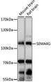 SEMA4G / Semaphorin 4G Antibody - Western blot analysis of extracts of various cell lines, using SEMA4G antibody at 1:1000 dilution. The secondary antibody used was an HRP Goat Anti-Rabbit IgG (H+L) at 1:10000 dilution. Lysates were loaded 25ug per lane and 3% nonfat dry milk in TBST was used for blocking. An ECL Kit was used for detection and the exposure time was 5s.