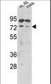 SENP1 Antibody - Western blot of hSENP1-K578 in HL-60, HeLa cell line lysates (35 ug/lane). SENP1 (arrow) was detected using the purified antibody.