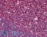 SENP1 Antibody - Anti-SENP1 antibody IHC of human tonsil. Immunohistochemistry of formalin-fixed, paraffin-embedded tissue after heat-induced antigen retrieval. Antibody concentration 5 ug/ml.  This image was taken for the unconjugated form of this product. Other forms have not been tested.