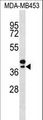 SEPP1 / Selenoprotein P Antibody - SEPP1 Antibody western blot of MDA-MB453 cell line lysates (35 ug/lane). The SEPP1 antibody detected the SEPP1 protein (arrow).