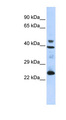 SEPP1 / Selenoprotein P Antibody - SEPP1 antibody Western blot of 293T cell lysate. This image was taken for the unconjugated form of this product. Other forms have not been tested.