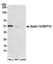 SEPT10 /Septin 10 Antibody - Detection of human Septin 10/SEPT10 by western blot. Samples: Whole cell lysate (50 µg) from HeLa, HEK293T, and Jurkat cells prepared using NETN lysis buffer. Antibody: Affinity purified rabbit anti-Septin 10/SEPT10 antibody used for WB at 0.1 µg/ml. Detection: Chemiluminescence with an exposure time of 3 minutes.