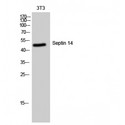SEPT14 Antibody - Western blot of Septin 14 antibody