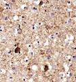 SERF1A / SERF1 Antibody - Immunohistochemistry: SERF1A Antibody - Analysis of SERF1A in human Alzheimer's brain using DAB with hematoxylin counterstain.  This image was taken for the unconjugated form of this product. Other forms have not been tested.