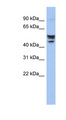 SERINC2 Antibody - SERINC2 antibody Western blot of Jurkat lysate. This image was taken for the unconjugated form of this product. Other forms have not been tested.