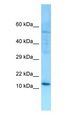 SERP1 Antibody - SERP1 antibody Western Blot of MCF7.  This image was taken for the unconjugated form of this product. Other forms have not been tested.