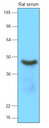SERPINA12 / Vaspin Antibody - Rat serum (15 ug) was resolved by SDS-PAGE, transferred to NC membrane and probed with anti-human Vaspin (1:2000). Proteins were visualized using a goat anti-mouse secondary antibody conjugated to HRP and an ECL detection system.