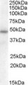 SERPINA12 / Vaspin Antibody - Antibody (0.5 ug/ml) staining of Human Adipose lysate (35 ug protein in RIPA buffer). Primary incubation was 1 hour. Detected by chemiluminescence